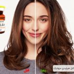 کوکتل مزوتراپی هیر لیدی مزولایک
